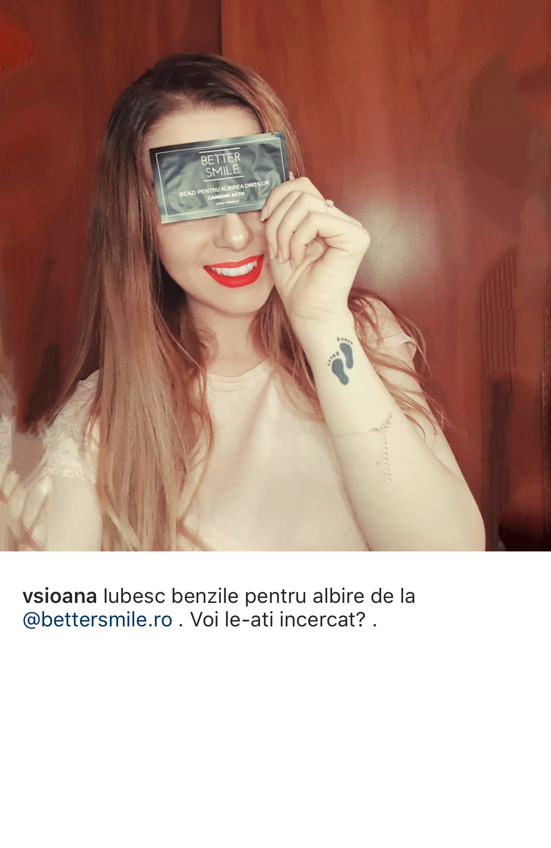 Benzi Carbune Activ BetterSmile Instagram 6