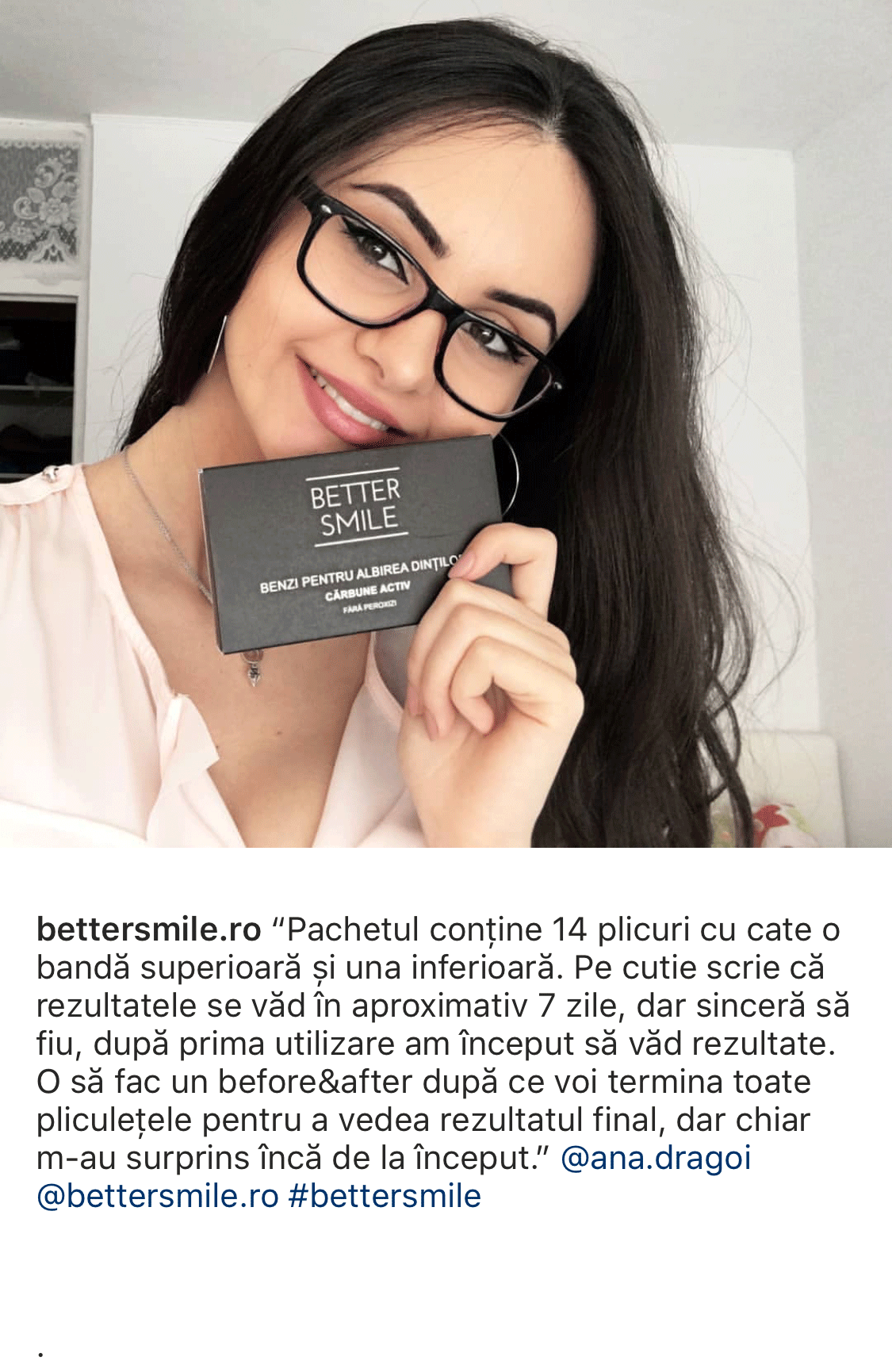 Benzi Carbune Activ BetterSmile Instagram 7